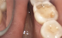 SDS - Smile Design Studio