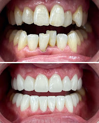 Smile Centrum Eliška – Zubní klinika Praha 9