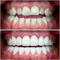 Smile Centrum Eliška – Zubní klinika Praha 9