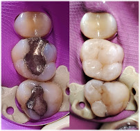 FullDent