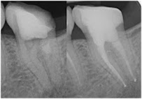 FullDent