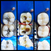 FullDent