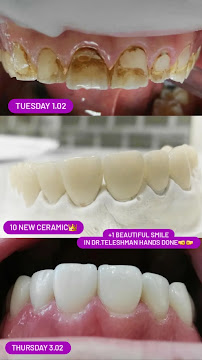 Dentální Centrum Klamovka Dr.Teleshman