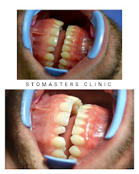MDDr. Marwan Sajed - Stomasters