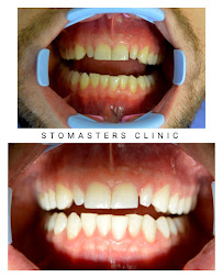 MDDr. Marwan Sajed - Stomasters