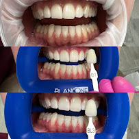 Dentální hygiena Andrea Halapejová, DiS. - Varydental
