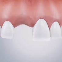 The Ivory Dental Clinic ( คลินิกทันตกรรม ดิไอวรี่ ) ศูนย์รากฟันเทียม วีเนียร์ จัดฟันใส ครอบฟัน ฟันปลอม