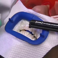 The Ivory Dental Clinic ( คลินิกทันตกรรม ดิไอวรี่ ) ศูนย์รากฟันเทียม วีเนียร์ จัดฟันใส ครอบฟัน ฟันปลอม