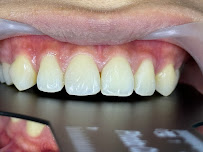 Bangkok Smile Dental Clinic Sukhumvit 21 | Asoke Branch