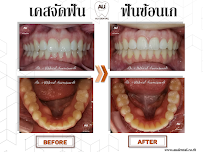 Au Dental Clinic (คลินิกทันตกรรม เอยู)
