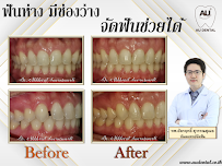 Au Dental Clinic (คลินิกทันตกรรม เอยู)