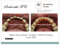 Au Dental Clinic (คลินิกทันตกรรม เอยู)
