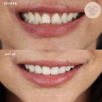The Happy Teeth Dental Clinic Sukhumvit 93 (Line ID: happpyteeth93)