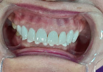 Silom Family Dental House