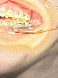 BFC Dental Srinagarindra