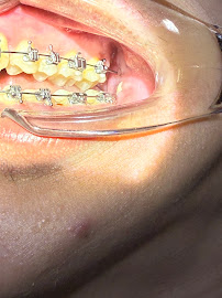 BFC Dental Srinagarindra