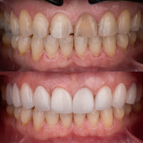 Proud Dental