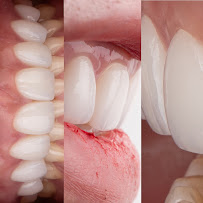 Proud Dental