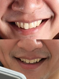 Smile Collection Dental Clinic