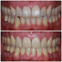 Tender Loving Dental Care. TLDC