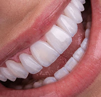 Clínica Dental Protesis Inmediatas