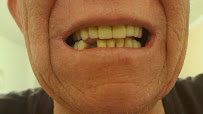 Večné Zuby — Smile Clinic Bratislava