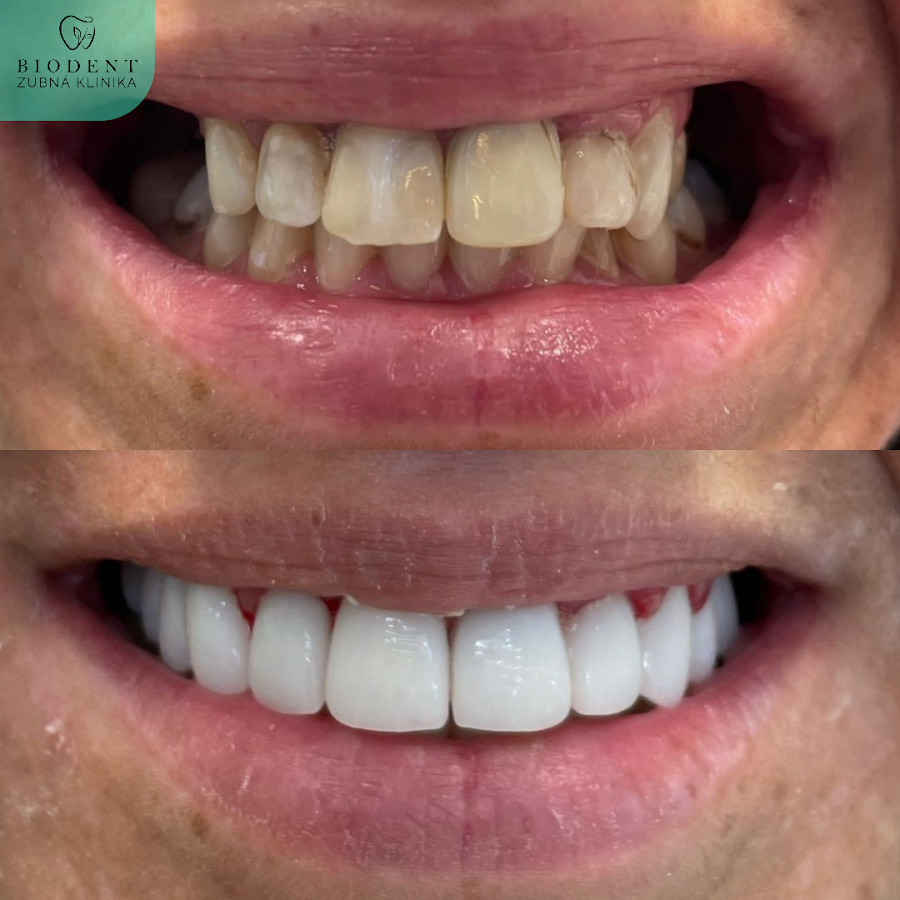 BioDent Bratislava - dental clinic in Bratislava, Slovakia