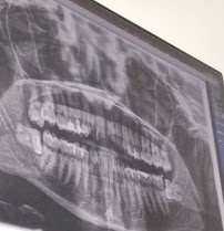 Zubár Tsap dental clinic