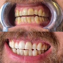 Dental Brothers