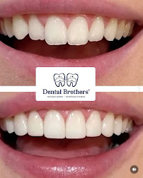 Dental Brothers