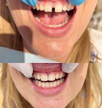 Dental Brothers - Nivy