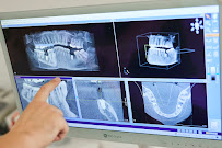 Hollywood Smile