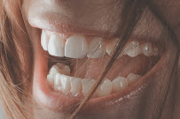 Zubná ambulancia Žilina - Planeta Dental Clinic