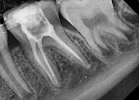 Royal Dent