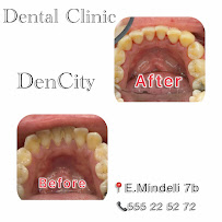 Dencity dental clinic დენსითი სტომატოლოგიური კლინიკა