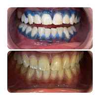 Dencity dental clinic დენსითი სტომატოლოგიური კლინიკა
