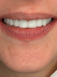 Dencity dental clinic დენსითი სტომატოლოგიური კლინიკა