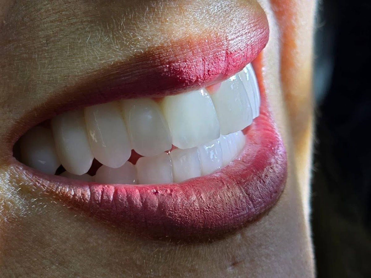 Smile Studio