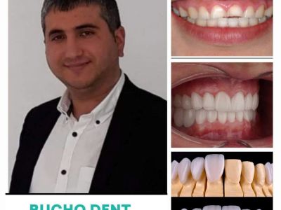 Bucho Denti in Tbilisi, Georgia, photograph 11