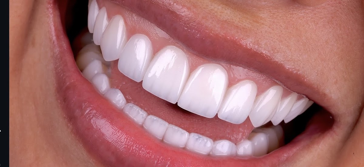 Bucho Denti