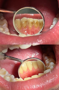 რემეა სტომატოლოგიური კლინიკა • REMEA Dental Clinic
