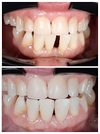 Centro Estético Dental Playa