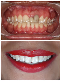 Centro Estético Dental Playa