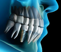 Centro Estético Dental Playa