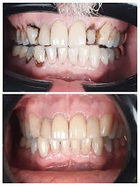 Centro Estético Dental Playa