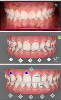 Kaab Dental Experts