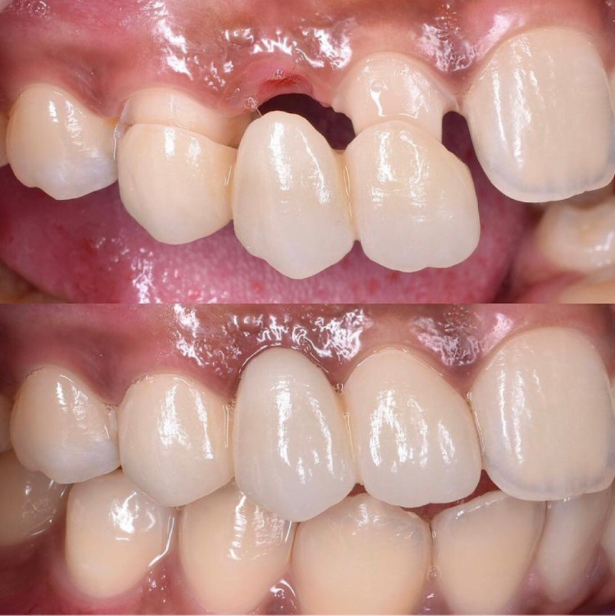 Amazing Dental dental clinic in Playa Del Carmen