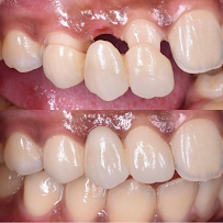 Amazing Dental in Playa Del Carmen