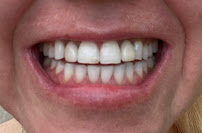 Itzia Dental Health