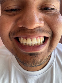 Dentista en Playa del Carmen Da tu mejor sonrisa!